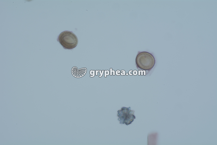 Taenia saginata, oeufs dans déjections x100 - gryphea.org